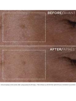 Double Serum