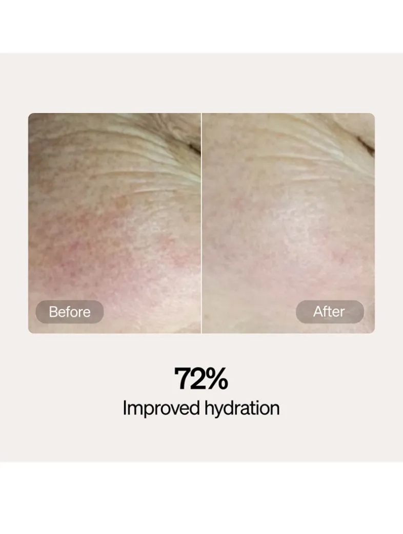 Skincare Serum and Cream Starter Kit